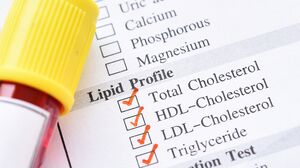 Lipid-test.jpg